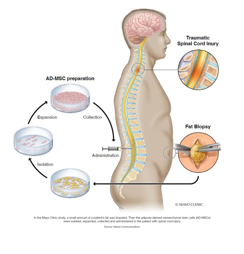 case study spinal cord injury answers