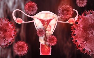 Mayo scientists explore swabs for early endometrial, ovarian cancer ...