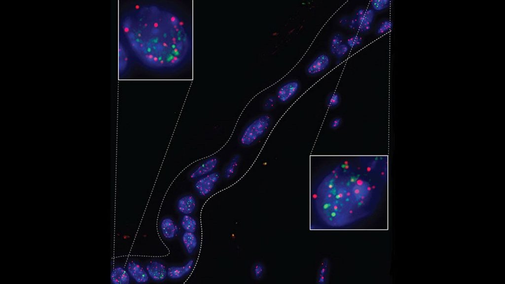 Representative microscopy image of aged skin with increased DNA-damage (depicted in green) within telomeres (in red), a biomarker associated with cellular senescence and aging.