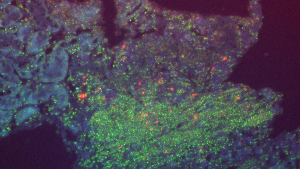 Microscopy image of the gene expression of Il23r (depicted in red), which increases in aged blood at the protein level, is present in aged kidney and is associated with the senescence marker p16 (shown in green).