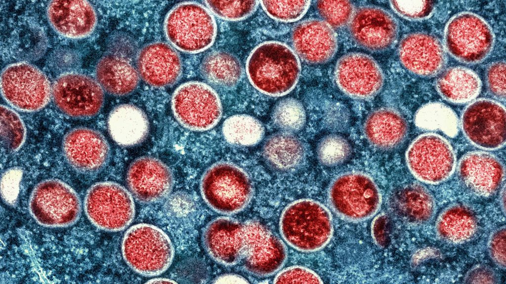 colorized transmission electron microscopic image of mpox virus particles (red), found within an infected cell (blue), that had been cultured in the laboratory. The image was captured and color-enhanced at the National Institute of Allergy and Infectious Diseases (NIAID), Integrated Research Facility (IRF), located in Fort Detrick, Maryland.