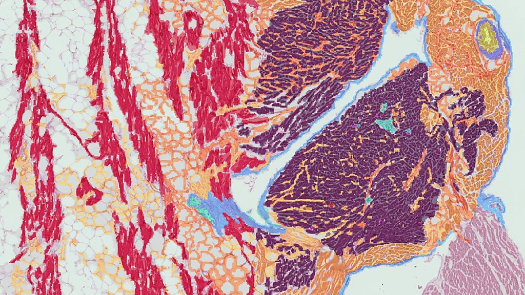 Graphical representation of cell types identified in a human postmortem cardiac tissue specimen by spatial transcriptomic profiling. (Image courtesy of Dr. Fatima Ezzeddine and Dr. Esther Lutgens. Analysis by Christy Trussoni, Will Sherman, and Mariam Stein.)