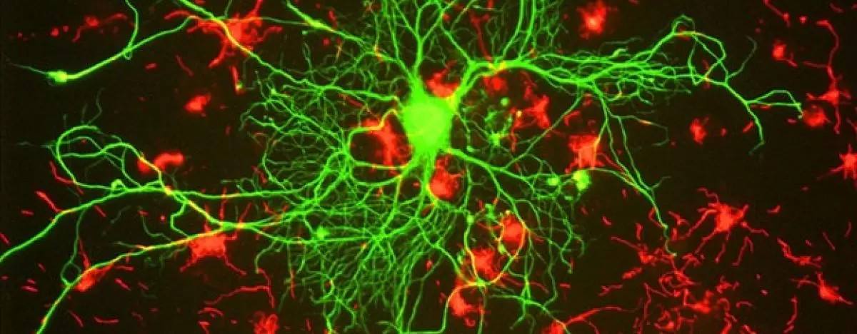 Mitochondrial dysfunction linked to Alzheimer’s onset and treatment ...