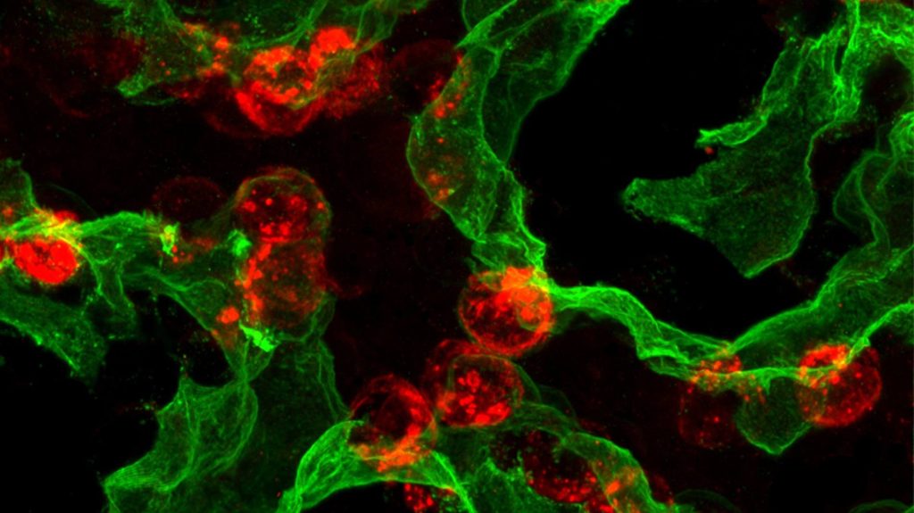 Microscopy image of lung cells.