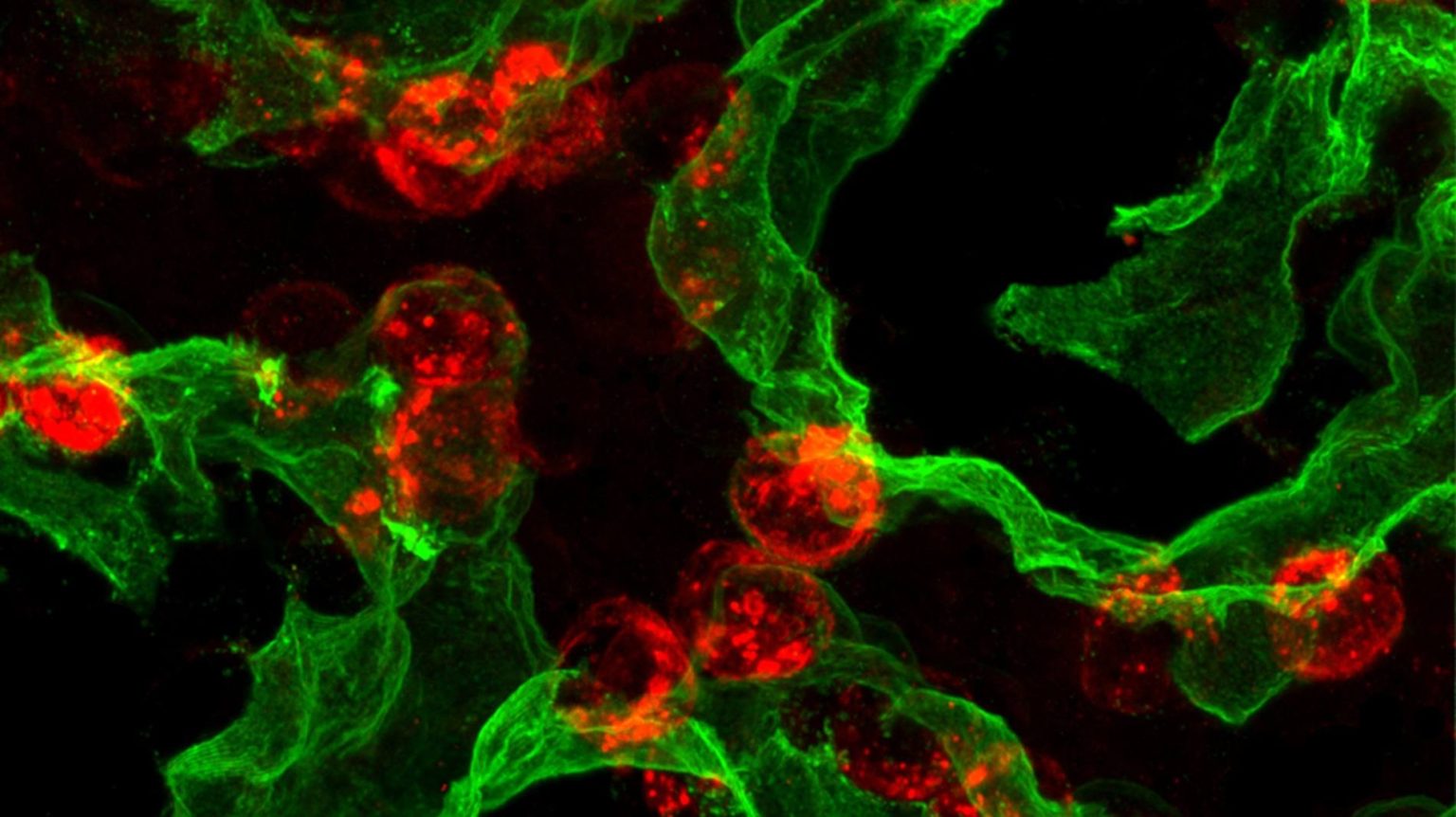 New discovery may unlock regenerative therapies for lung disease - Mayo ...
