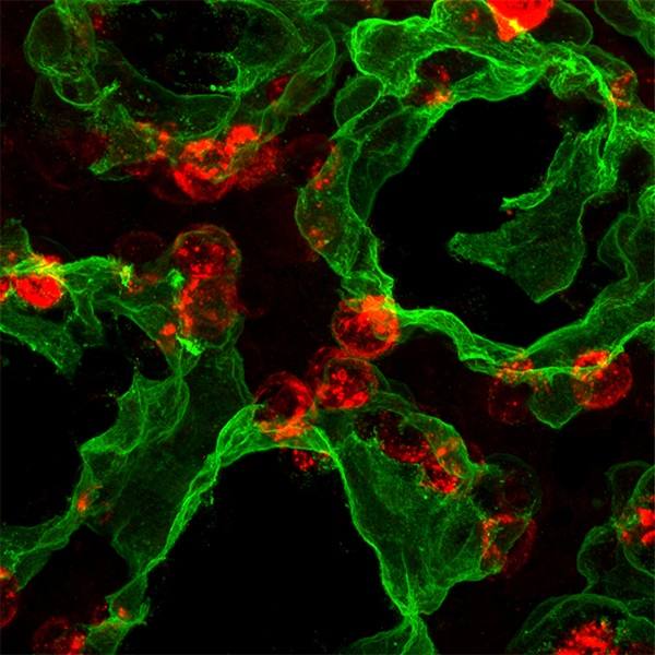 New discovery may unlock regenerative therapies for lung disease featured image
