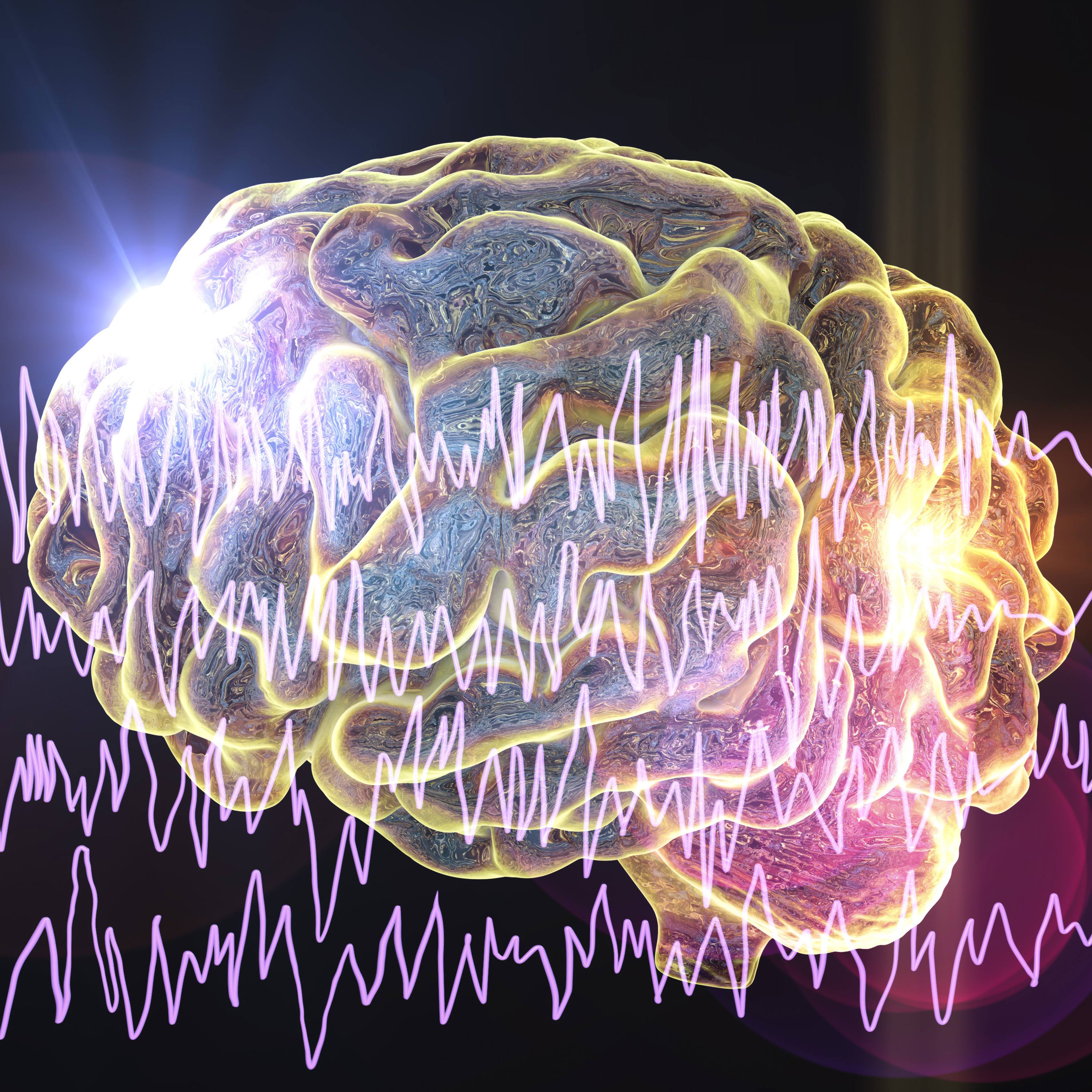 Innovation in epilepsy care: Alternatives to medication seek to reset, repair brain, expert explains featured image