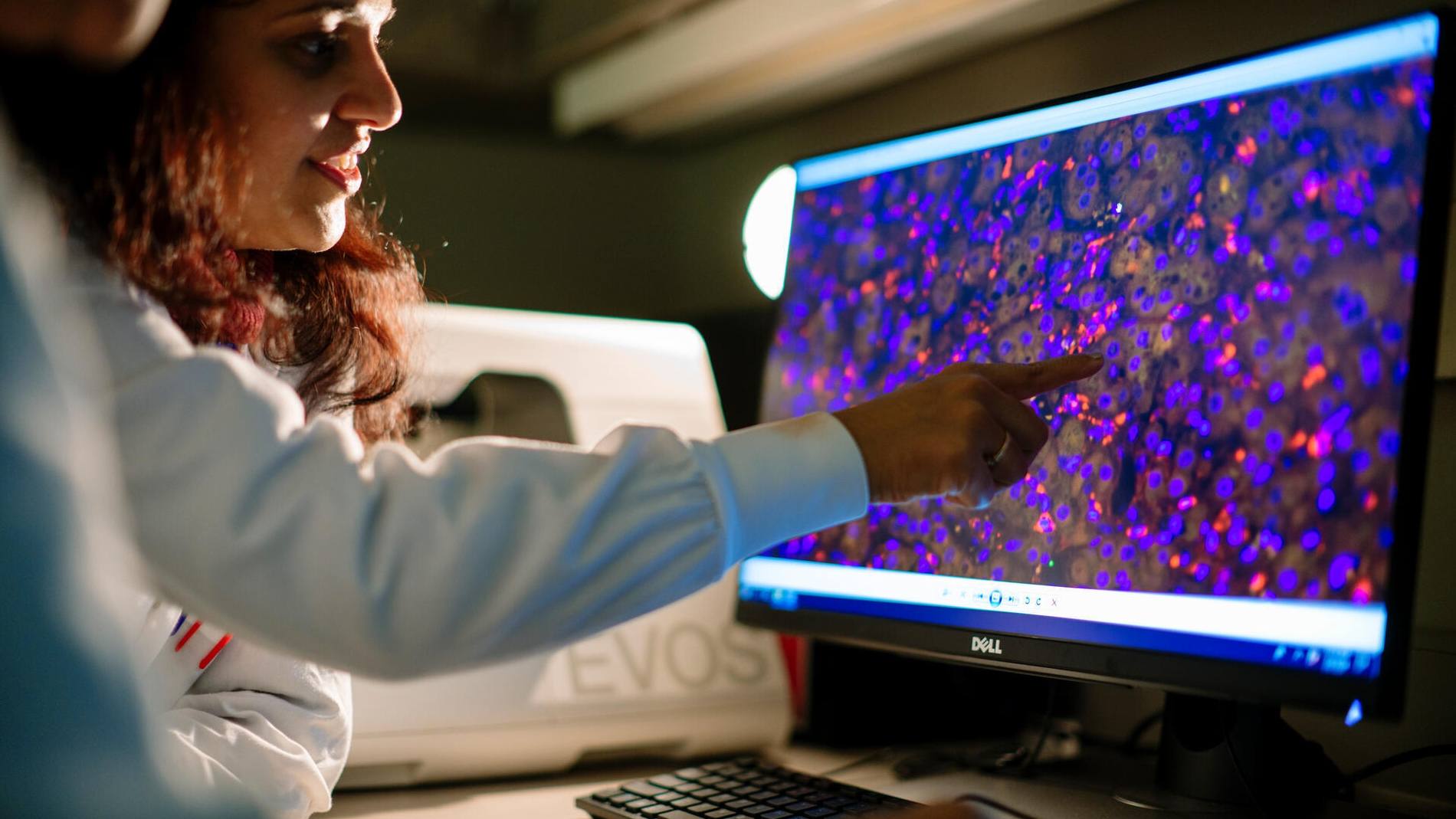 Mayo Clinic study sheds light on colorectal cancer risk in overlooked group featured image
