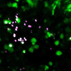 Mayo Clinic researchers find enhancing the body’s ‘first responder’ cells may boost immune therapy for cancer featured image