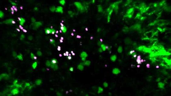 Mayo Clinic researchers find enhancing the body’s ‘first responder’ cells may boost immune therapy for cancer featured image