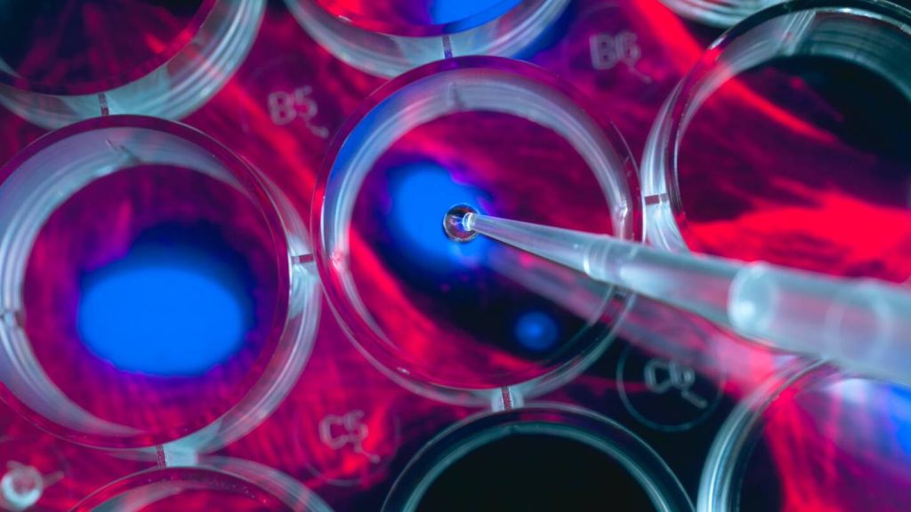 A researcher uses a pipette to place stem cells into a multiwell plate, with an image of the cells shown beneath.