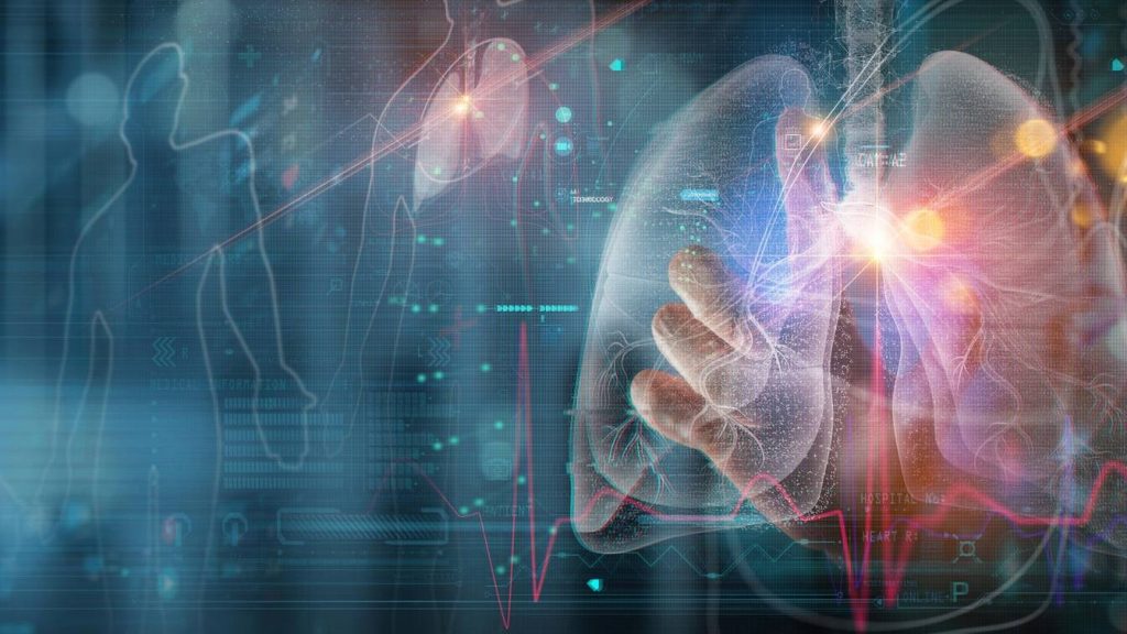 Virtual, digital lung image