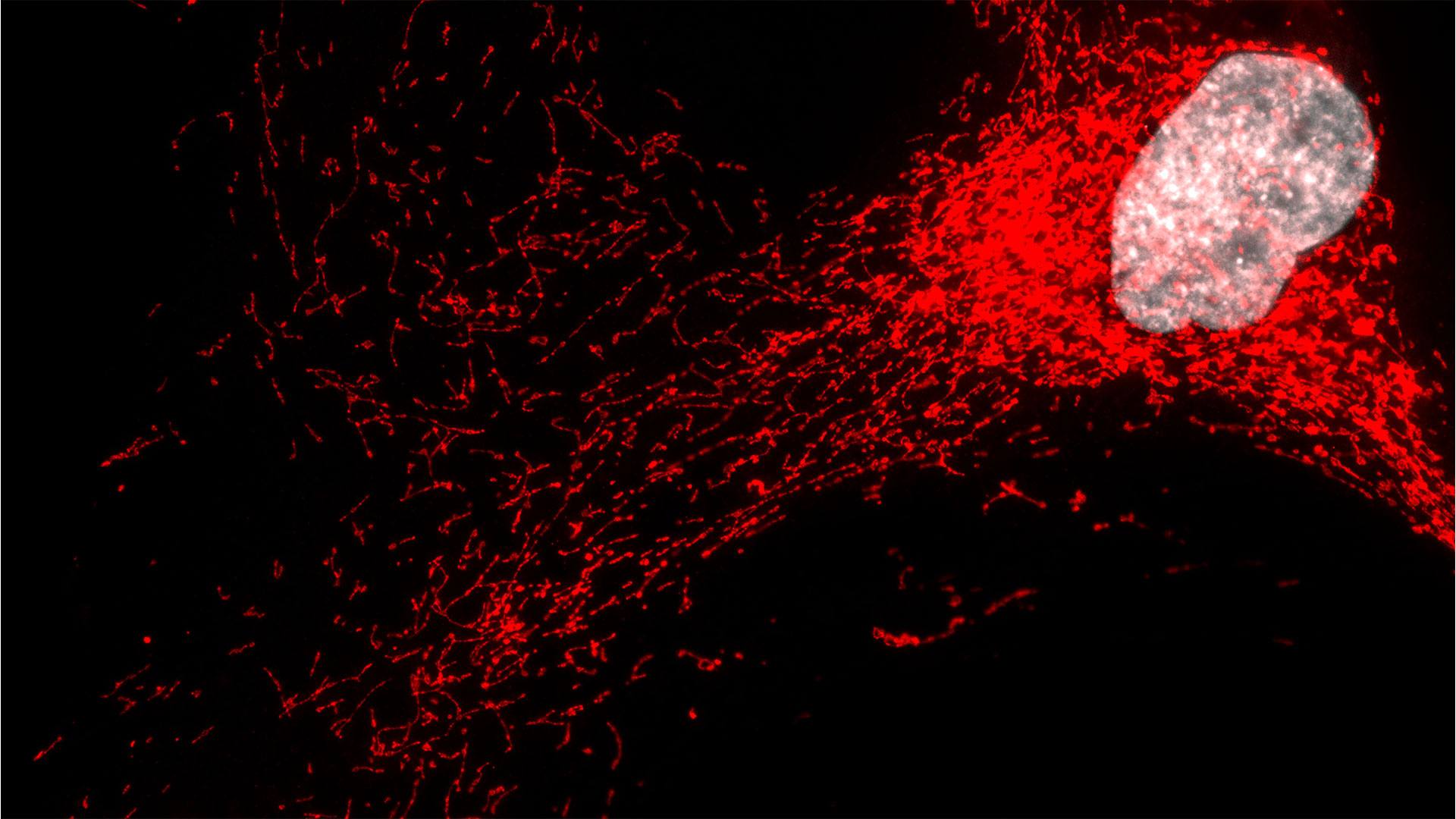 'Zombie' cells spark inflammation in severe fatty liver disease, Mayo Clinic researchers find  - Mayo Clinic News Network (via newsnetwork.mayoclinic.org)
