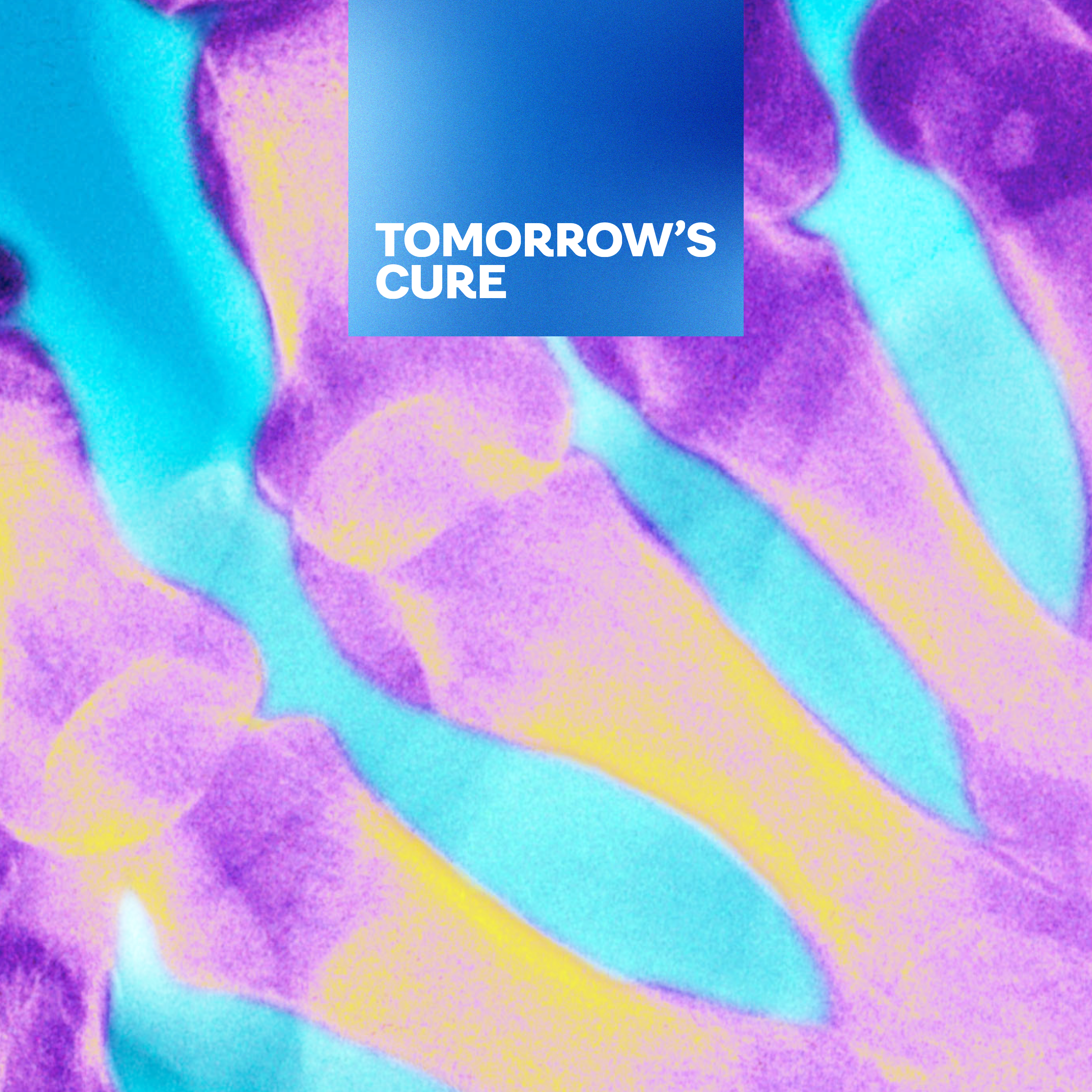 Rewriting the future of rheumatoid arthritis: How early detection is transforming prevention  featured image