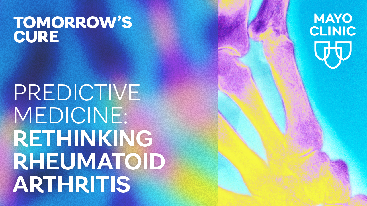 Rewriting the future of rheumatoid arthritis: How early detection is transforming prevention  featured image