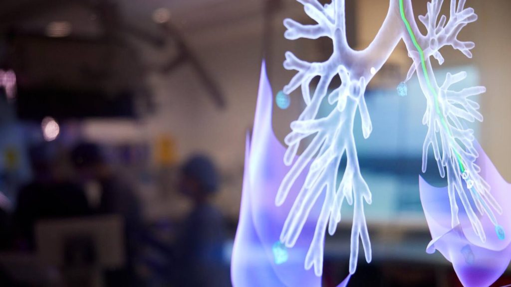 The screen on a robotic-assisted bronchoscopy machine shows a diagram of a patient's lungs.