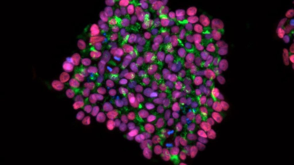 Mayo Clinic collaborates on ARPA-H award to develop a bioprinted liver for acute liver failure