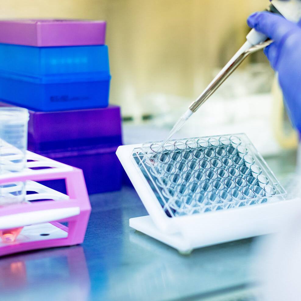 Mayo Clinic researchers find combination therapy reduces effects of ‘zombie cells’ in diabetic kidney disease featured image