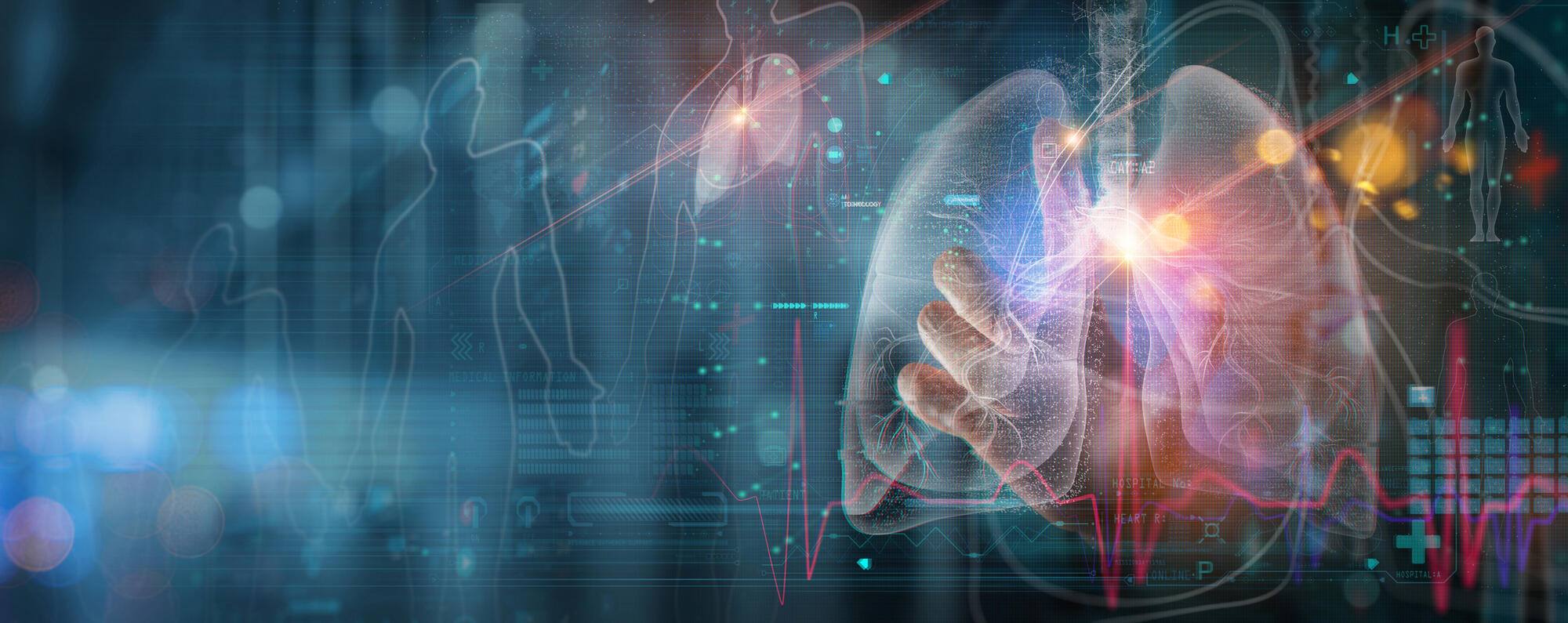 “Revolutionary Study Shows Wearable Tech Key to Boosting Patient Involvement in COPD Recovery”
