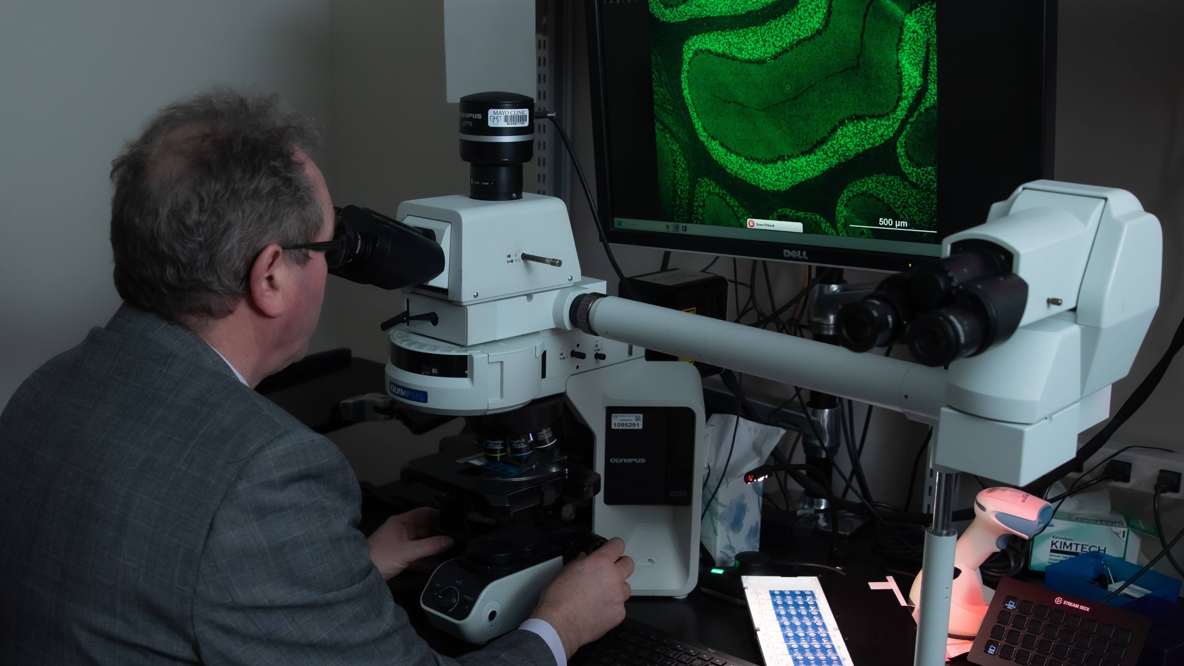 Using technology to treat Parkinson’s: Inside neurodegenerative movement disorders (VIDEO) featured image