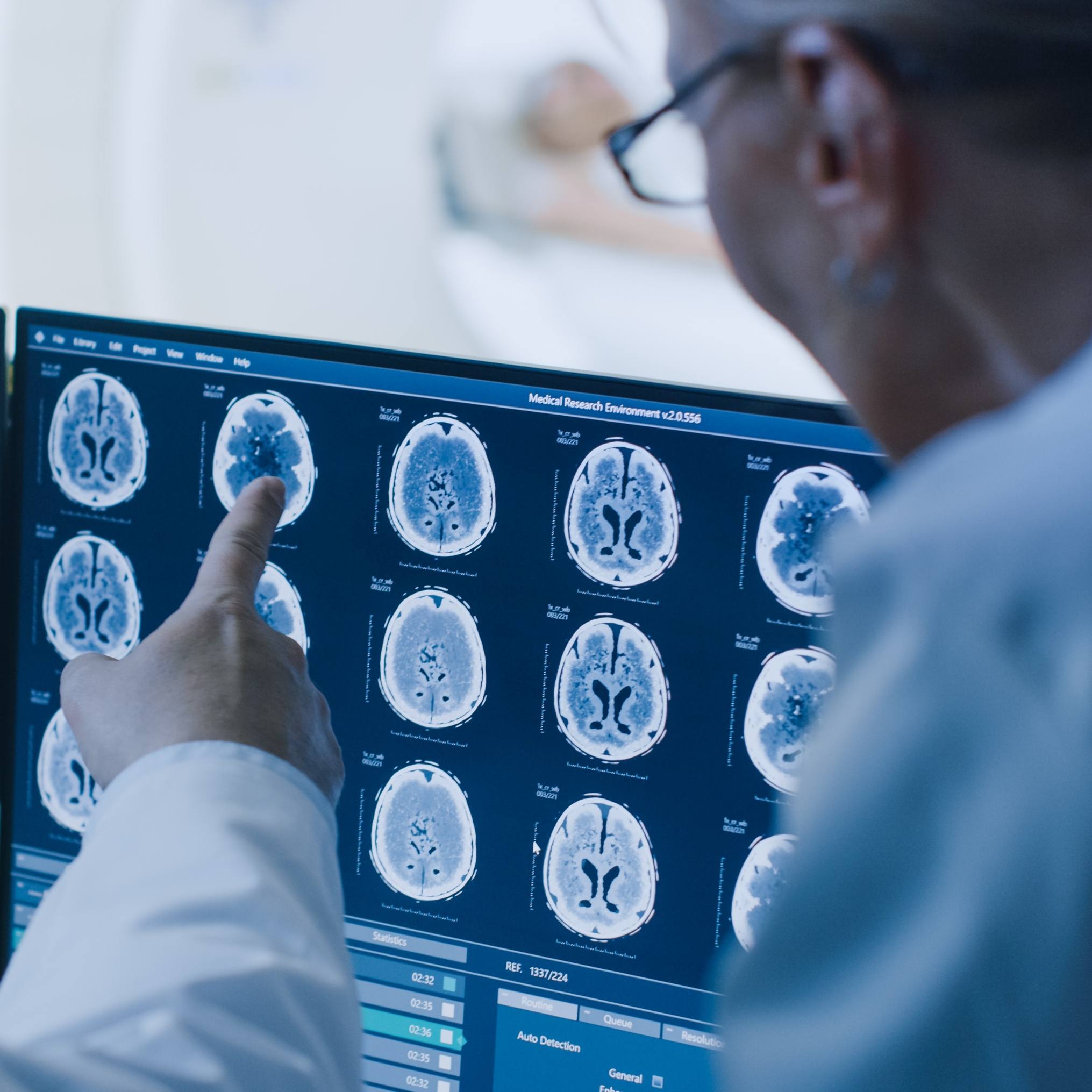 Mayo Clinic experimental dual-drug nanotherapy crosses the blood-brain barrier and improved survival in preclinical glioblastoma models featured image