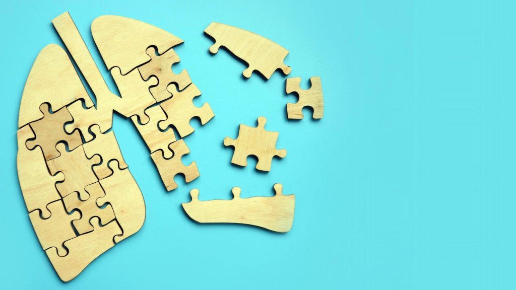 A pair of lungs made of puzzle pieces is only partially complete, isolated on a blue background.