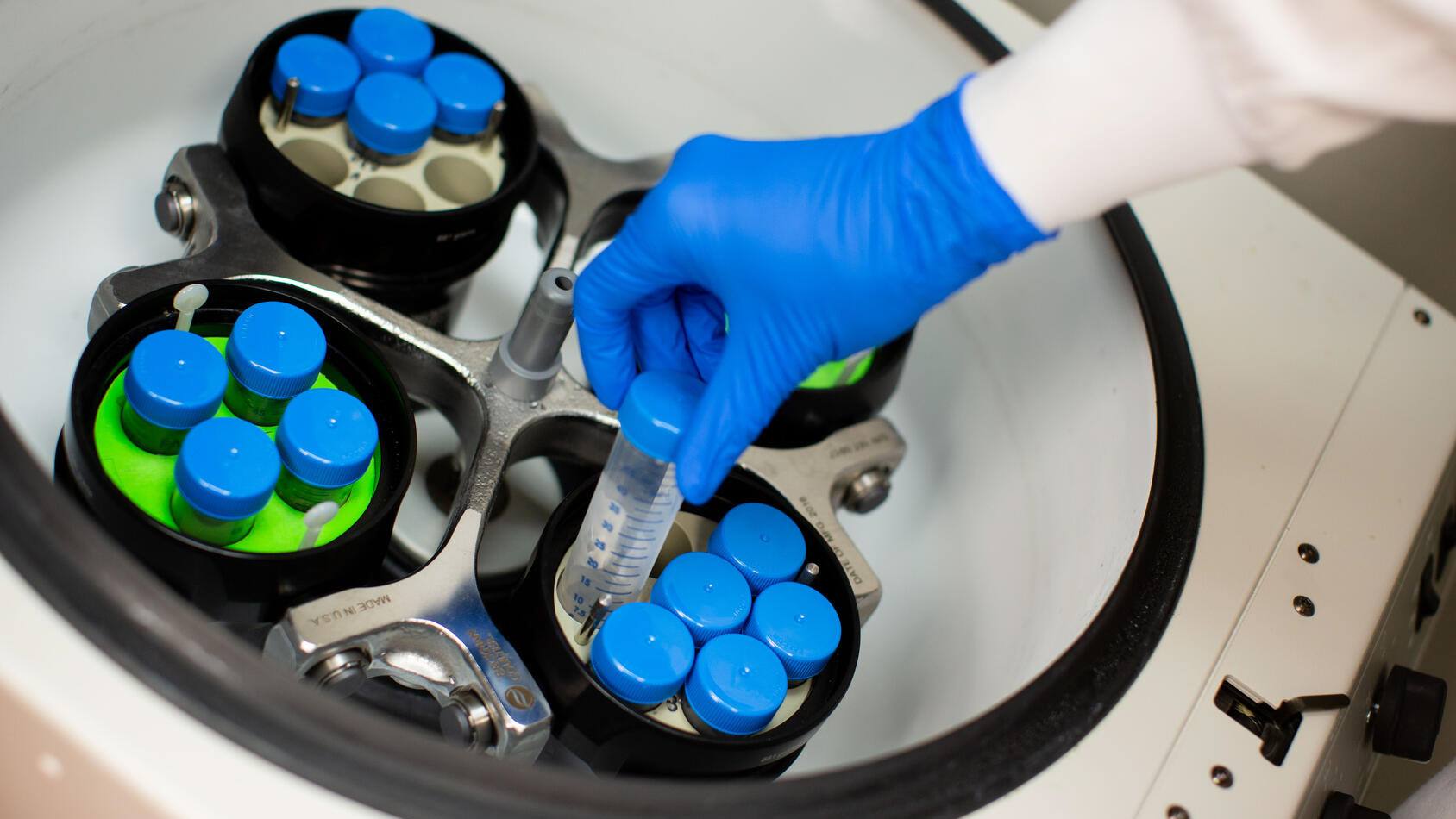 Mayo Clinic researchers identify molecule linked to treatment-resistant inflammatory bowel disease featured image