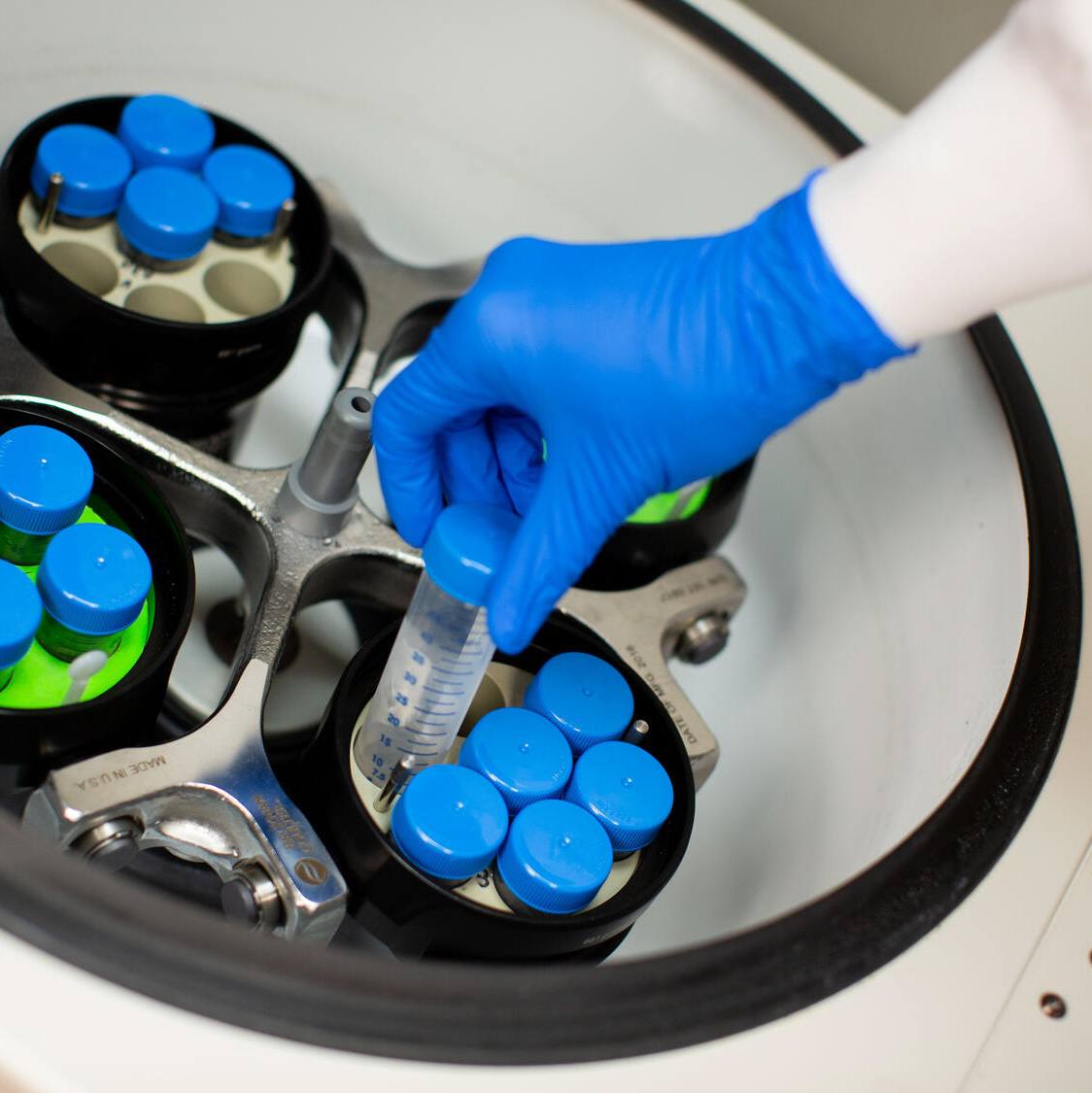 Mayo Clinic researchers identify molecule linked to treatment-resistant inflammatory bowel disease featured image