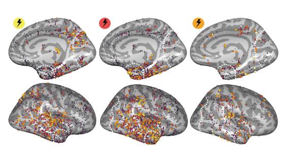 Figure showing pulvinar mapping
