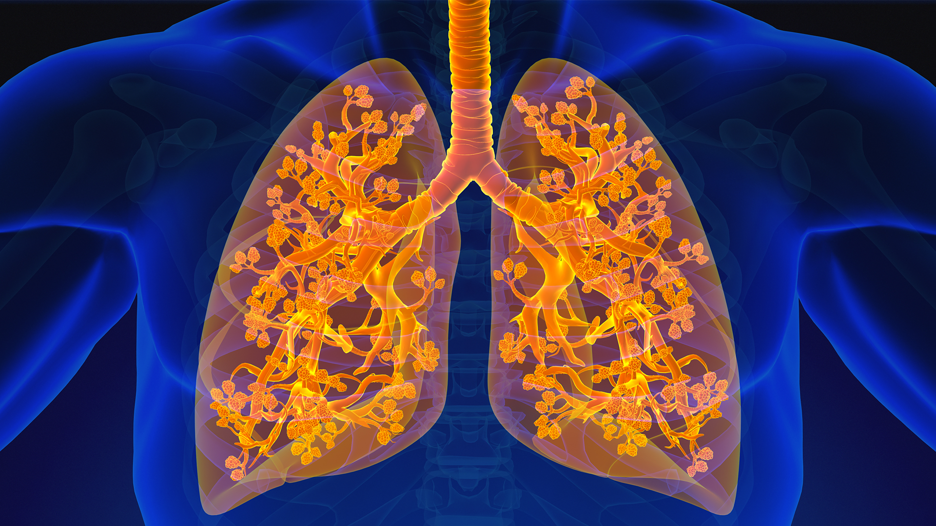 Researchers chart a genetic path to diagnosing pulmonary fibrosis and predicting outcomes featured image