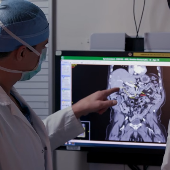 Colorectal cancer isn’t the only gastrointestinal cancer rising in young adults featured image