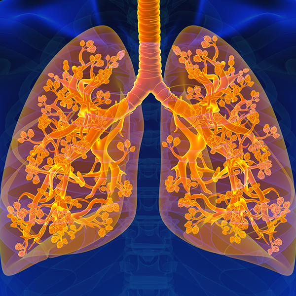 Researchers chart a genetic path to diagnosing pulmonary fibrosis and predicting outcomes featured image