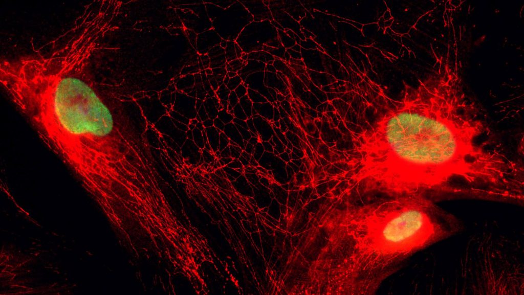 Microscopy image of the mitochondria network and staining of the histone acetylation.