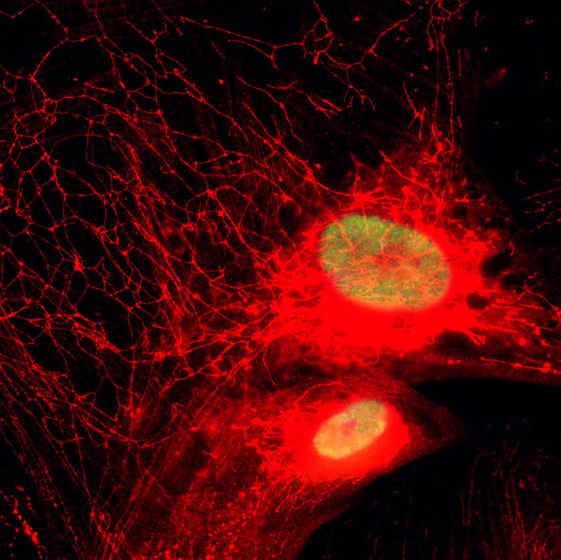Scientists identify new mitochondrial pathway linked to harmful inflammation in aging featured image