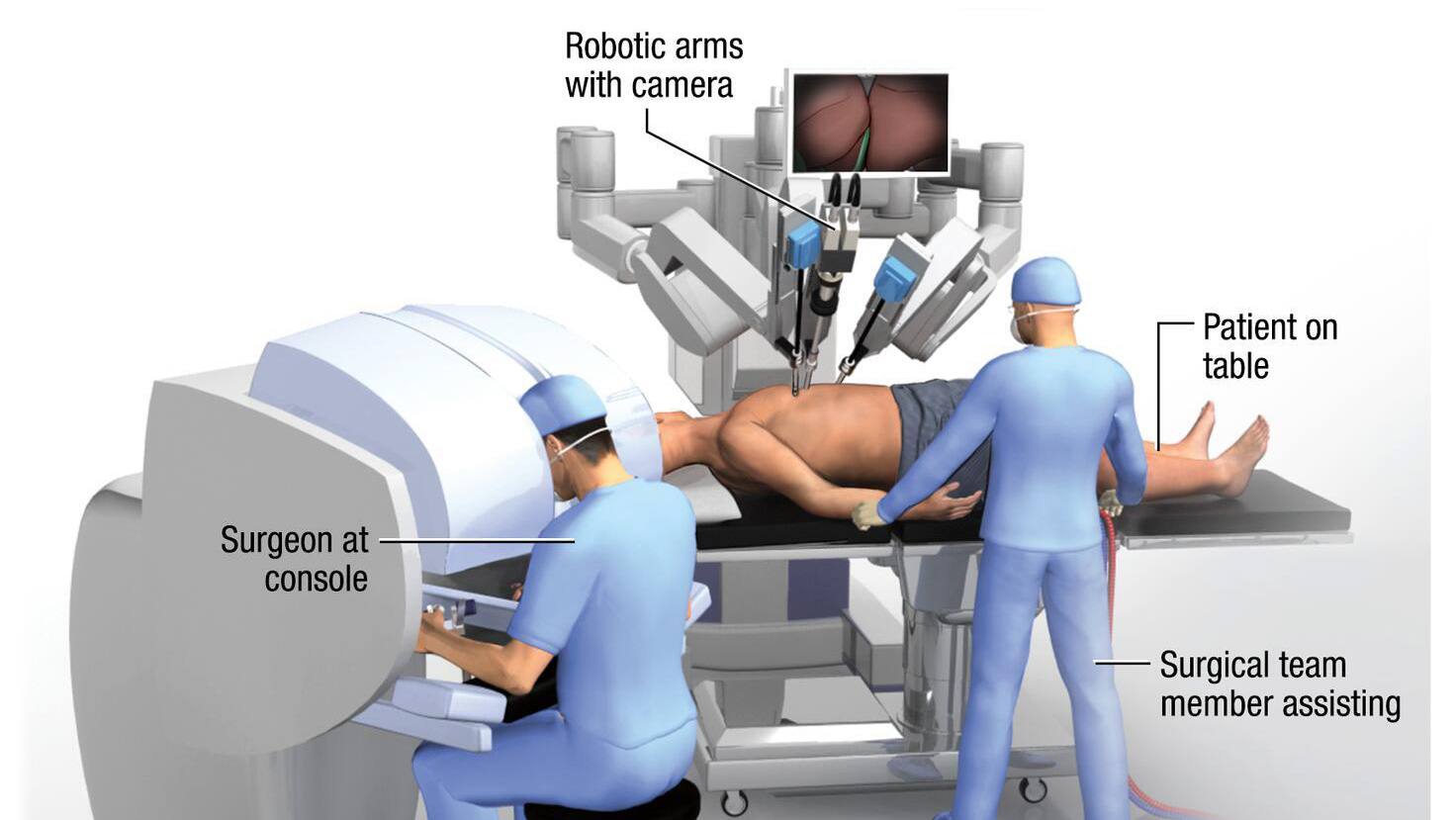 Mayo Clinic Q&A: How is robotic technology changing liver and abdominal surgery? featured image