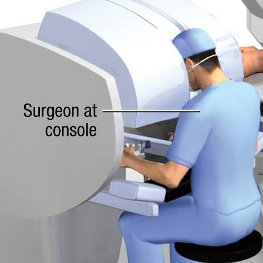 Mayo Clinic Q&A: How is robotic technology changing liver and abdominal surgery? featured image