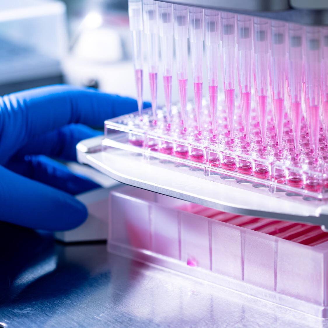 International study identifies promising therapy to prevent relapses in rare neurological disease featured image