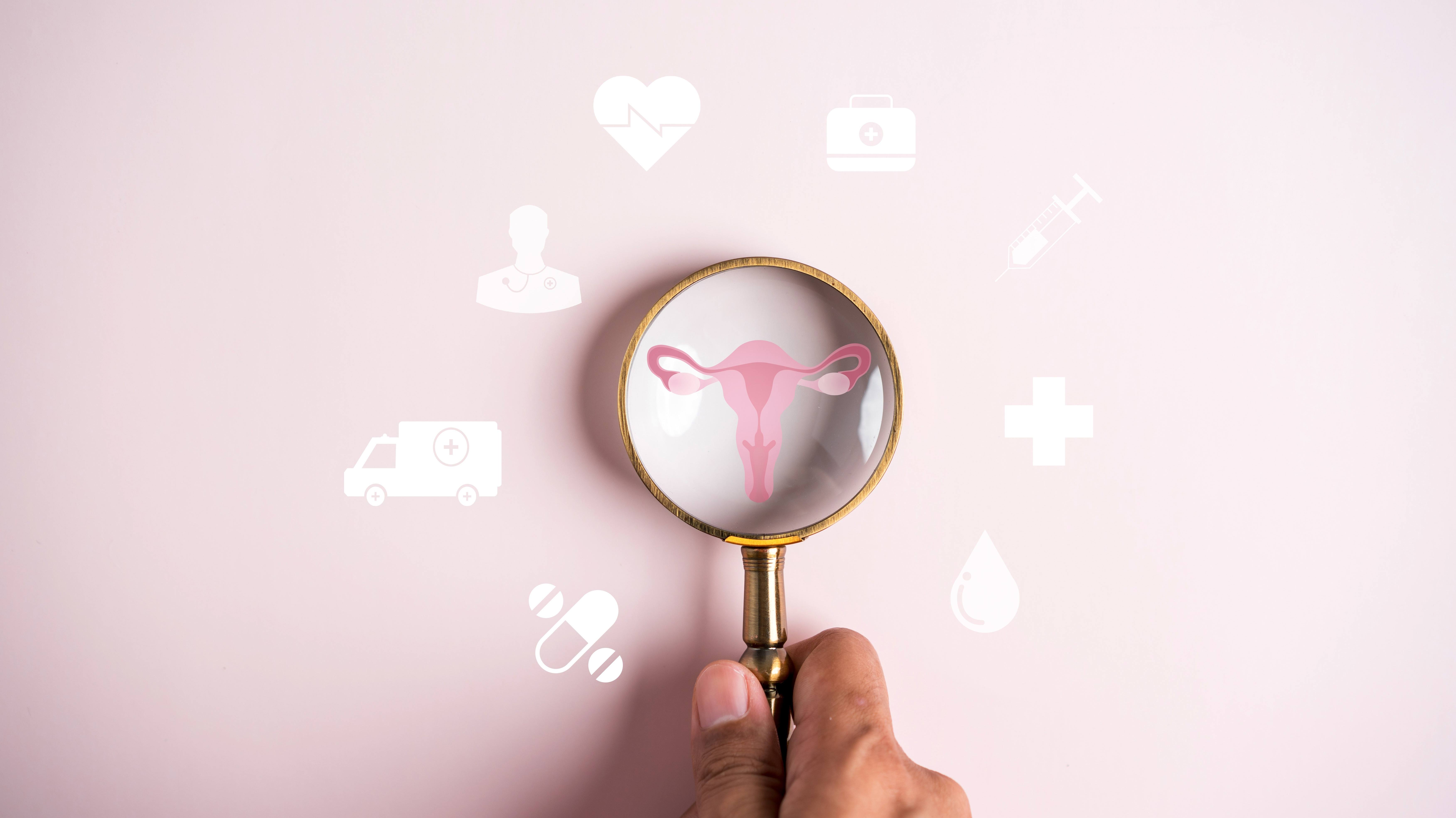 Mayo Clinic Q&A: What are 5 ovarian cancer signs women may overlook? featured image
