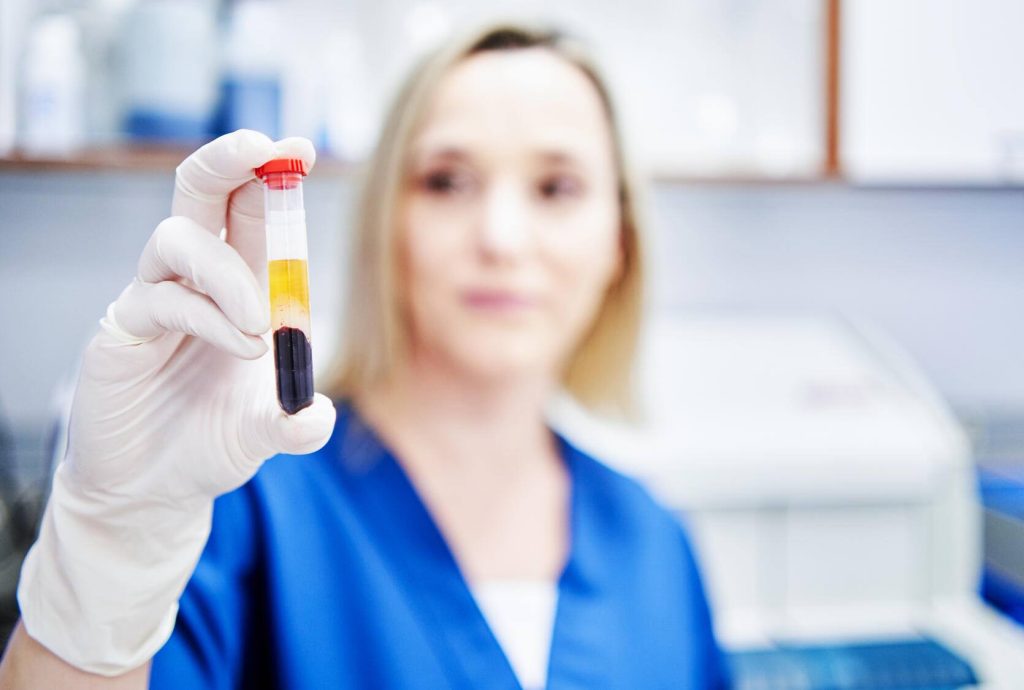 laboratory worker holding a tube with blood samples for testing