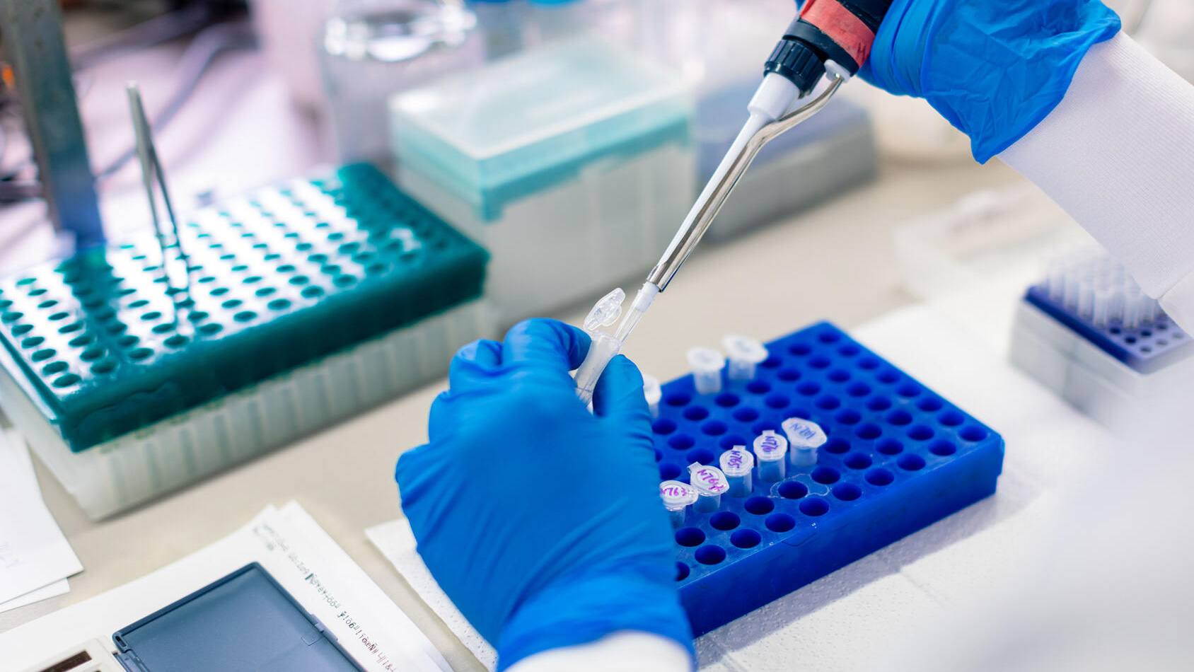 Mayo Clinic study explores cerebrospinal fluid DNA testing when brain tumor diagnosis is uncertain featured image