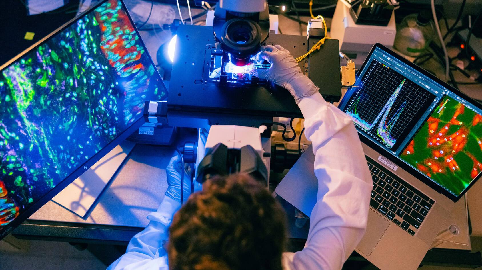 Investigational vaccine generates immune response to KRAS mutations in pancreatic cancer study featured image