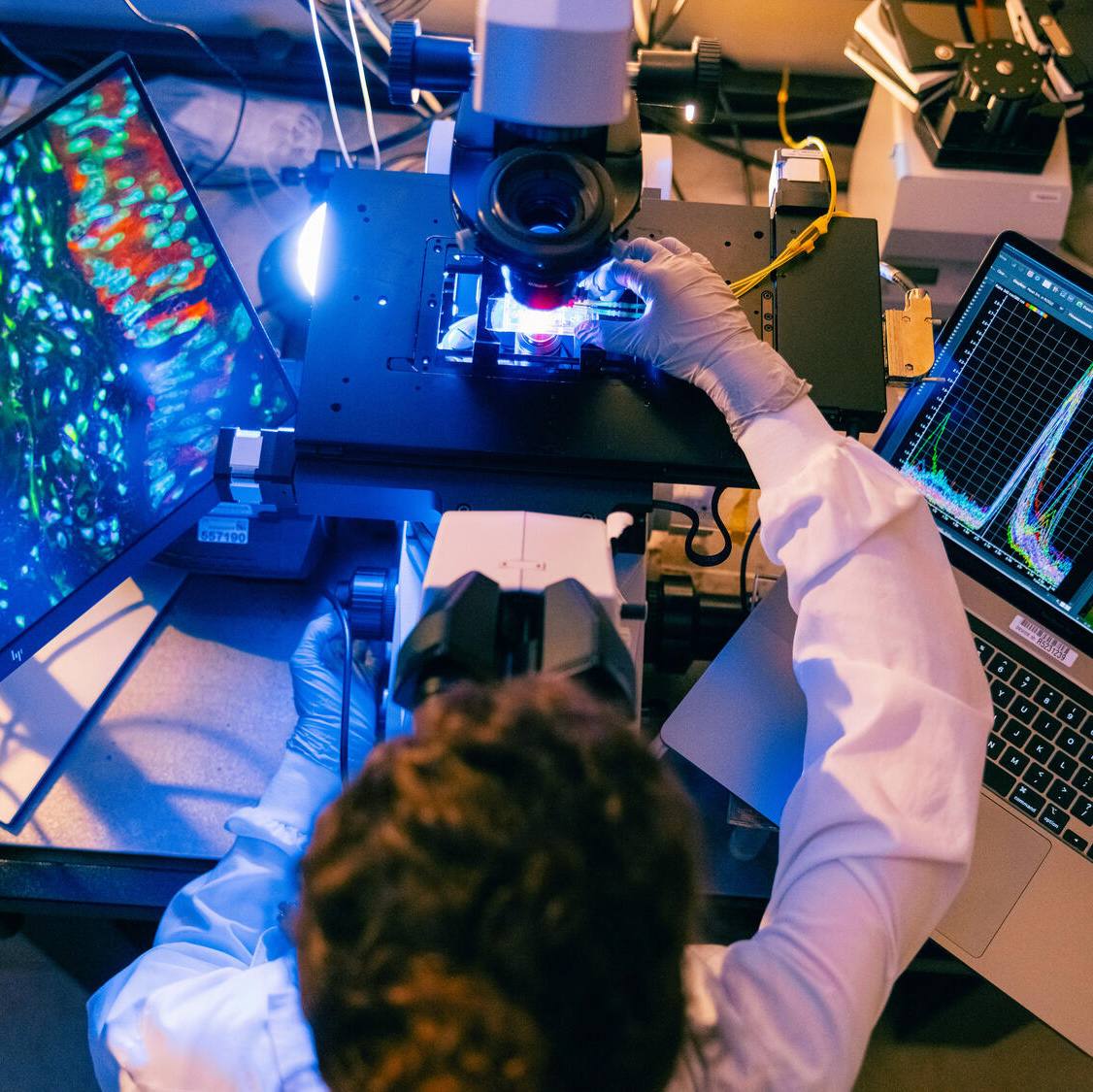 Investigational vaccine generates immune response to KRAS mutations in pancreatic cancer study featured image