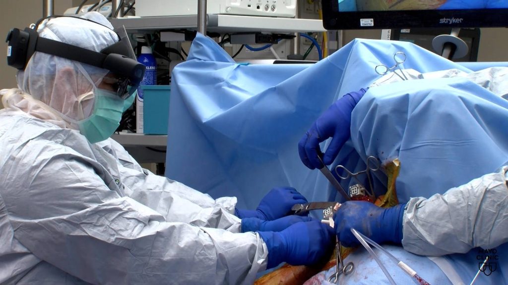 Alerta para los expertos: la navegación con realidad mixta proporciona una  trayectoria precisa durante una cirugía de prótesis de hombro - Red de  noticias de Mayo Clinic
