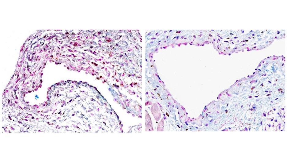 Células madre pueden ofrecer una nueva esperanza para el tratamiento de la enfermedad renal terminal featured image