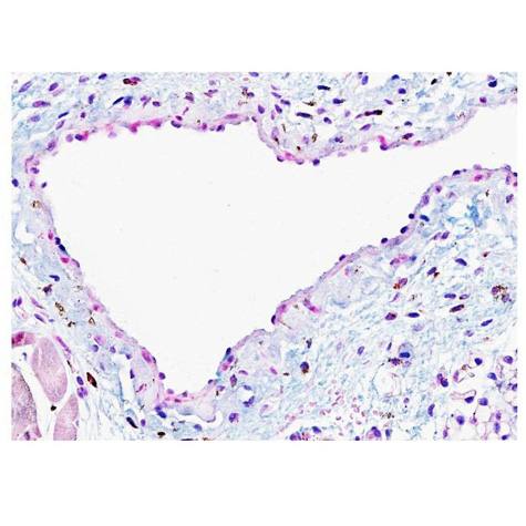 Células madre pueden ofrecer una nueva esperanza para el tratamiento de la enfermedad renal terminal featured image