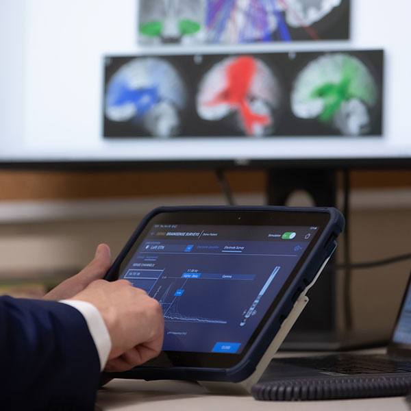 Mayo Clinic mapea ondas cerebrales de los pacientes para personalizar tratamiento de la epilepsia   featured image