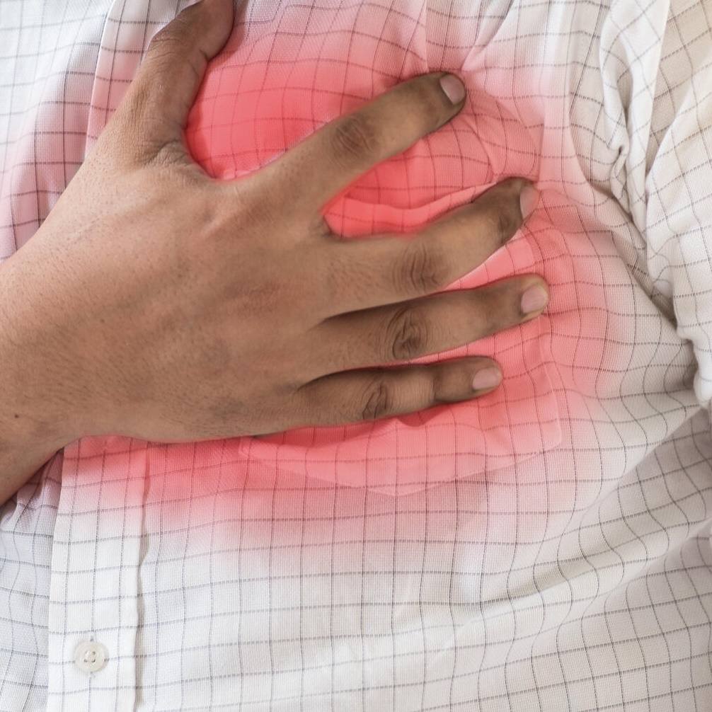 Preguntas y Respuestas de Mayo Clinic: Paro cardíaco vs. ataques cardíacos: ¿Quién está en riesgo? featured image