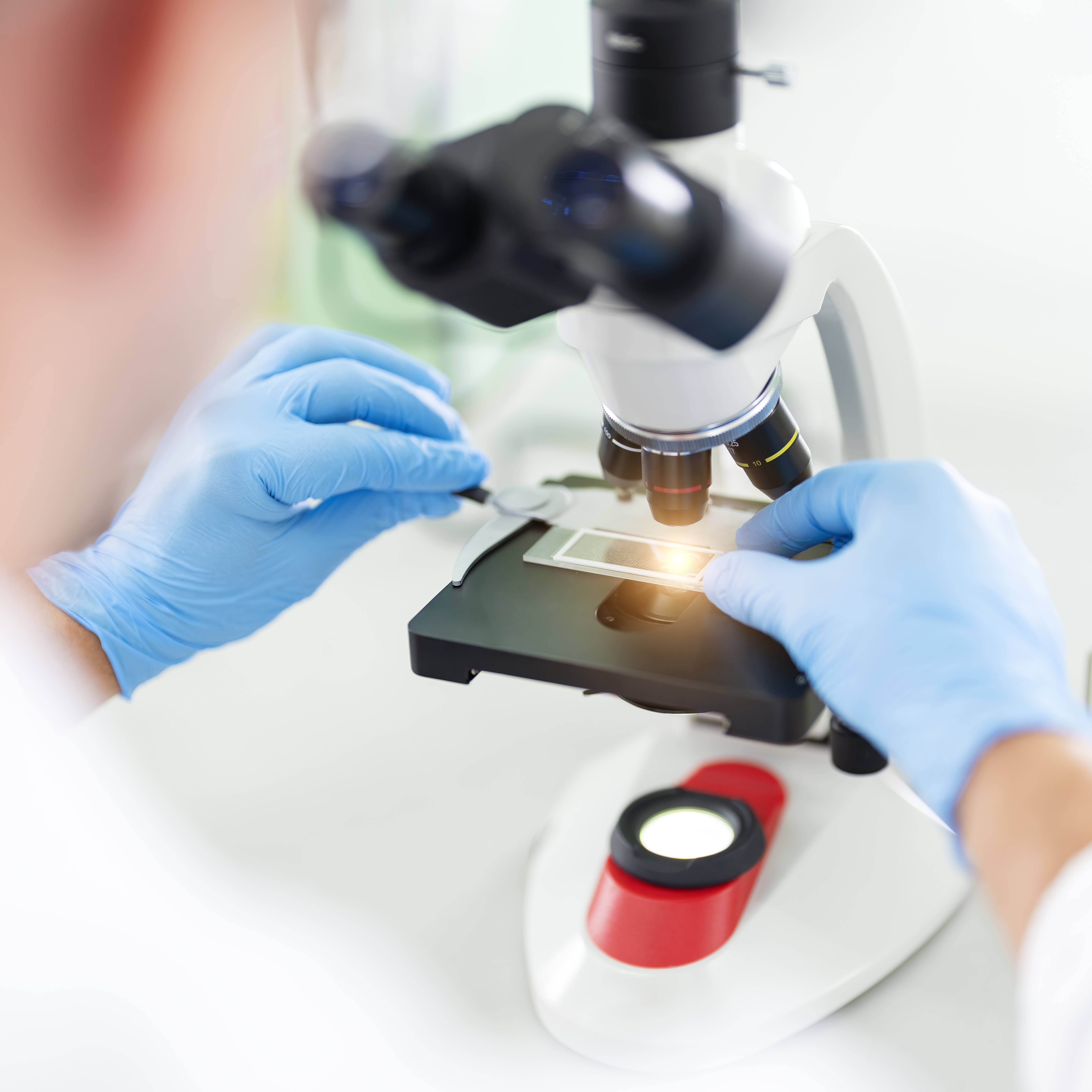 Investigadores de Mayo Clinic encuentran una nueva esperanza para el mieloma más difícil mediante inmunoterapia lista para usar featured image