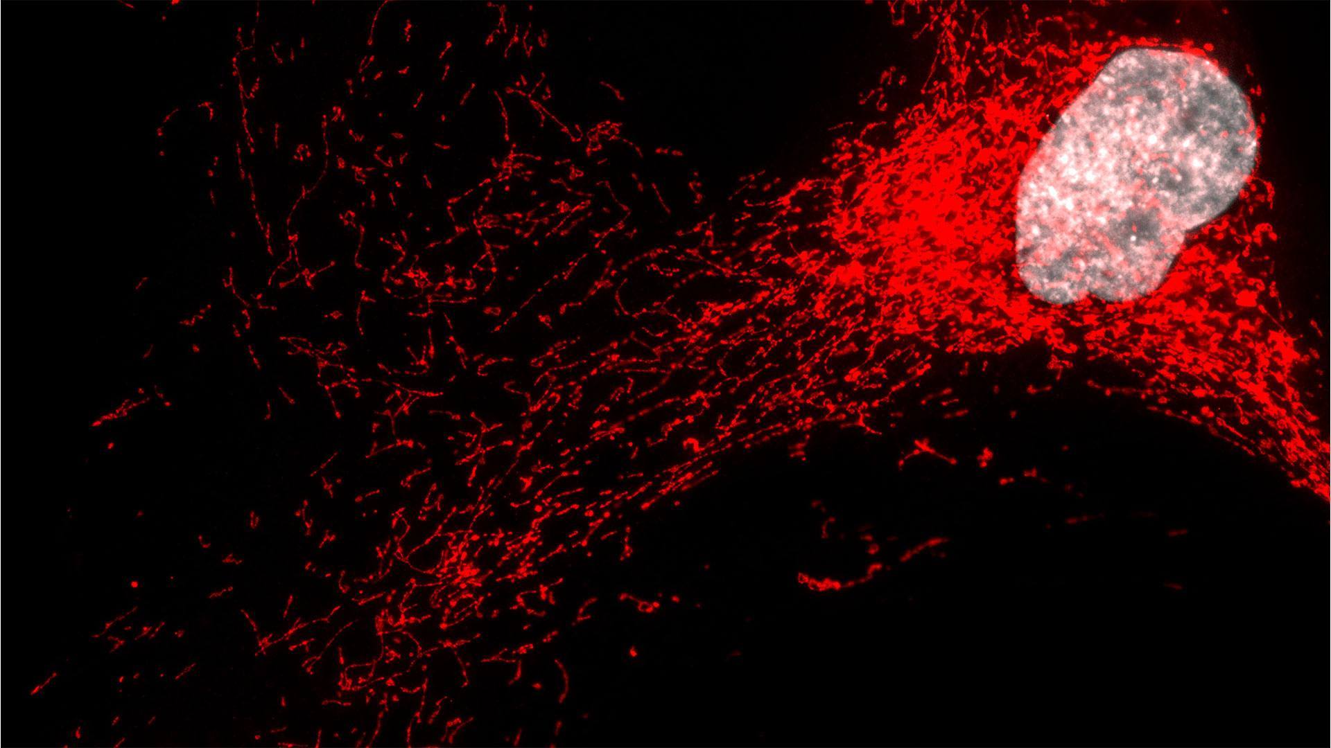 Células ‘zombi’ desencadenan inflamación en una forma grave de enfermedad hepática grasa, según investigadores de Mayo Clinic featured image