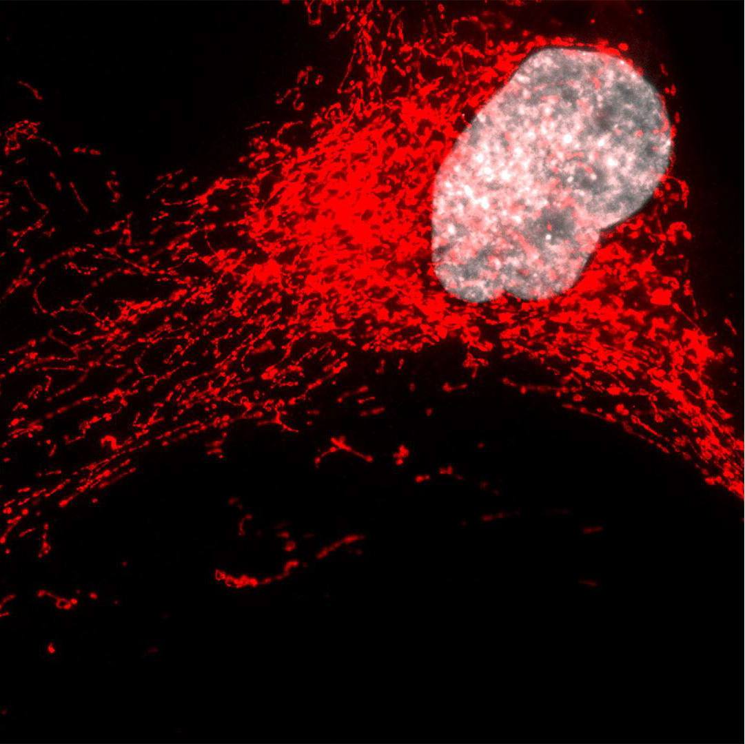 Células ‘zombi’ desencadenan inflamación en una forma grave de enfermedad hepática grasa, según investigadores de Mayo Clinic featured image